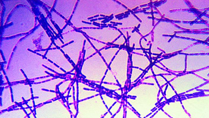 microscopy image of anthrax