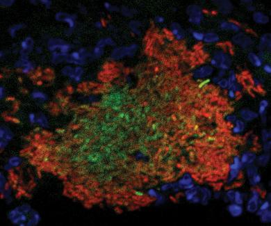 Yersinia replicating in the mouse spleen. Slow-growing bacteria responding to nitric oxide (red) protect interior bacteria (green). Neutrophils (blue) surround the bacterial cluster. Image courtesy of Kim Davis.